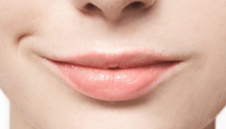 ATENCIÓN: Remedios caseros que te ayudarán a eliminar las grietas labiales