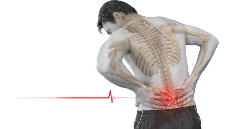 ATENCIÓN: Características de la fibrodisplasia osificante progresiva