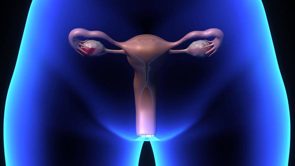 ATENCIÓN: Remedios para los Ovarios Poliquísticos