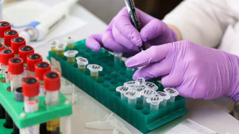 ATENCIÓN: Crean un nuevo fármaco oncológico que evita la metástasis y reduce el tumor