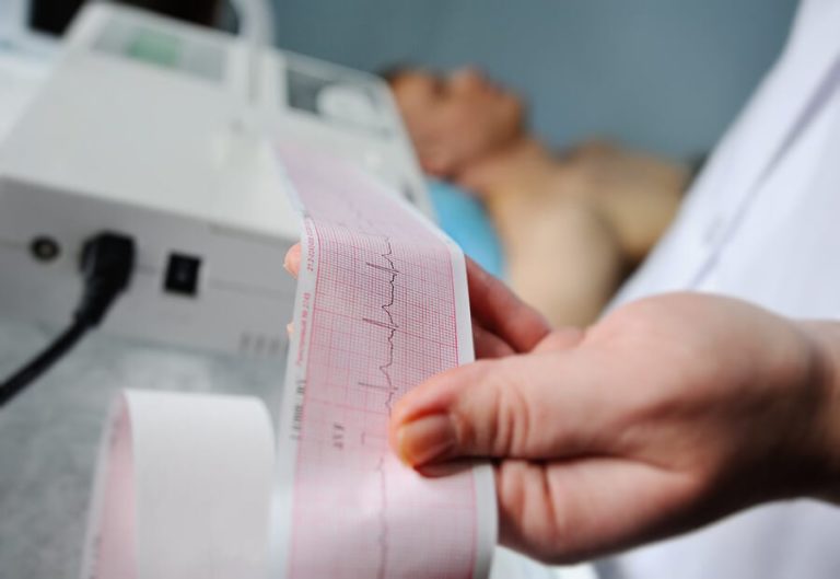 Holter: ¿ Electrocardiograma en qué consiste?
