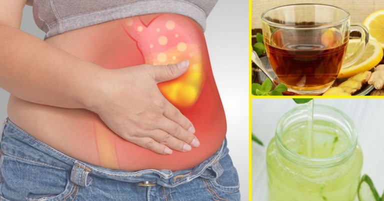ATENCIÓN: Alternativas naturales para tratar la acidez estomacal SIN tomar Omeprazol