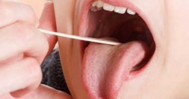 ATENCIÓN: Placas en la garganta: síntomas y tratamiento