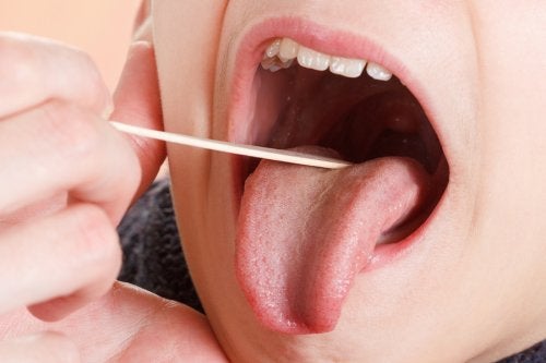 ATENCIÓN: Placas en la garganta: síntomas y tratamiento
