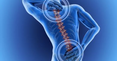 OJO: Cómo combatir y prevenir el dolor de espalda