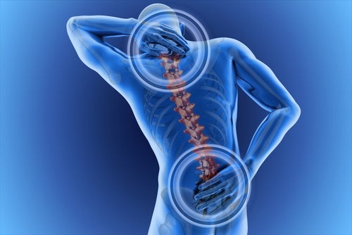 OJO: Cómo combatir y prevenir el dolor de espalda