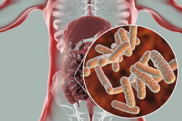 ANTIINFLAMATORIOS NATURALES PARA TRATAR EL DOLOR ARTICULAR
