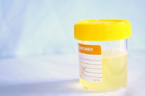 OJO: Remedios caseros para la infección urinaria