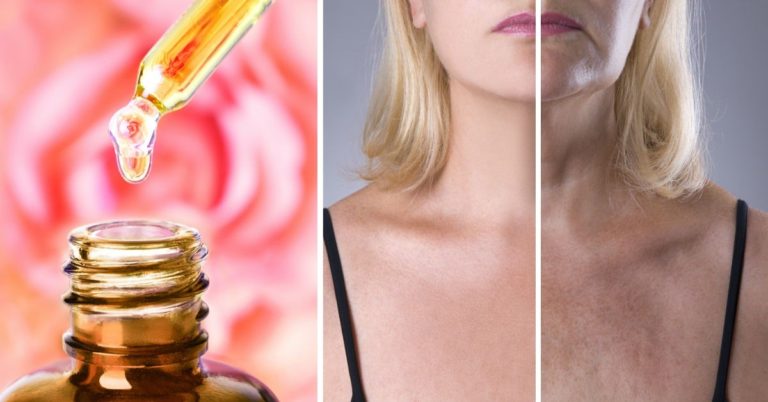 ATENCIÓN: Aceite de rosa mosqueta para eliminar las arrugas y tener una piel más bonita