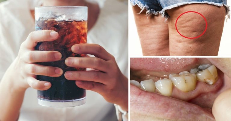 OJO: Daños en el cuerpo por tomar refresco light... afecta más de lo que crees