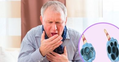 OJO: Enfermedad pulmonar obstructiva crónica (EPOC)