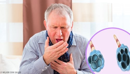 OJO: Enfermedad pulmonar obstructiva crónica (EPOC)