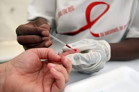 Estudio muestra VIH podría aumentar riesgo muerte súbita