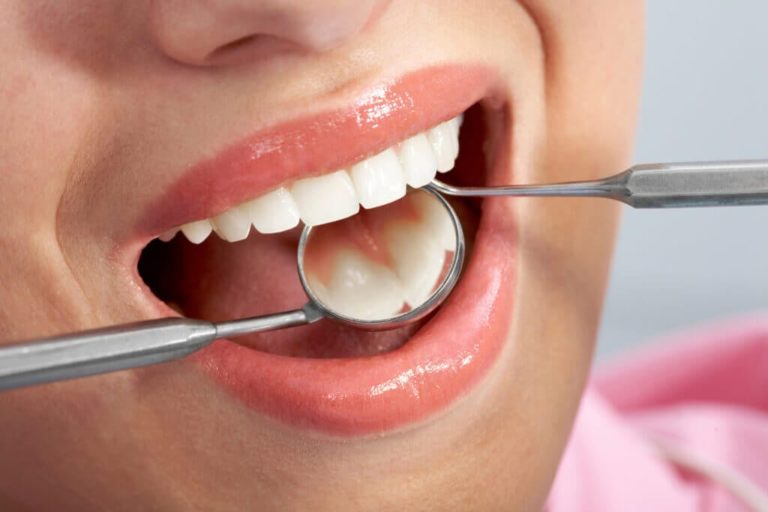 ATENCIÓN: Quistes en los dientes