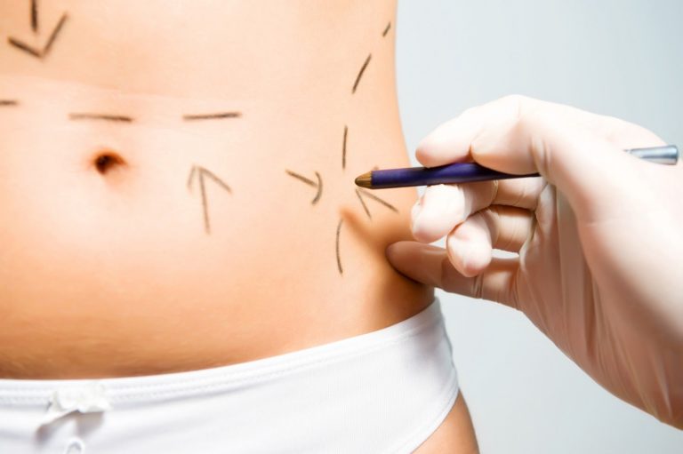 En el Gautier reciben hasta 10 pacientes semanales con cirugías mal hechas