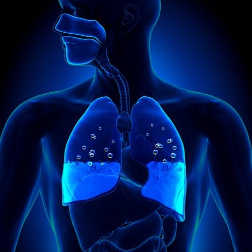 OJO: Edema pulmonar, ¿cuáles son sus síntomas y causas?