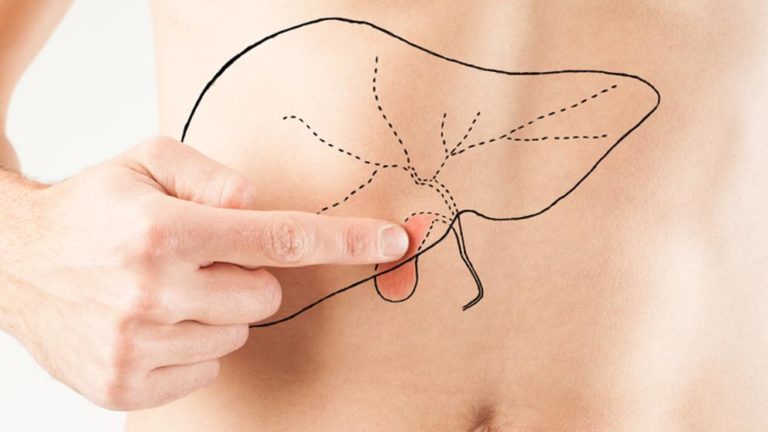 La microbiótica intestinal, aliado en la lucha contra la hepatitis alcohólica