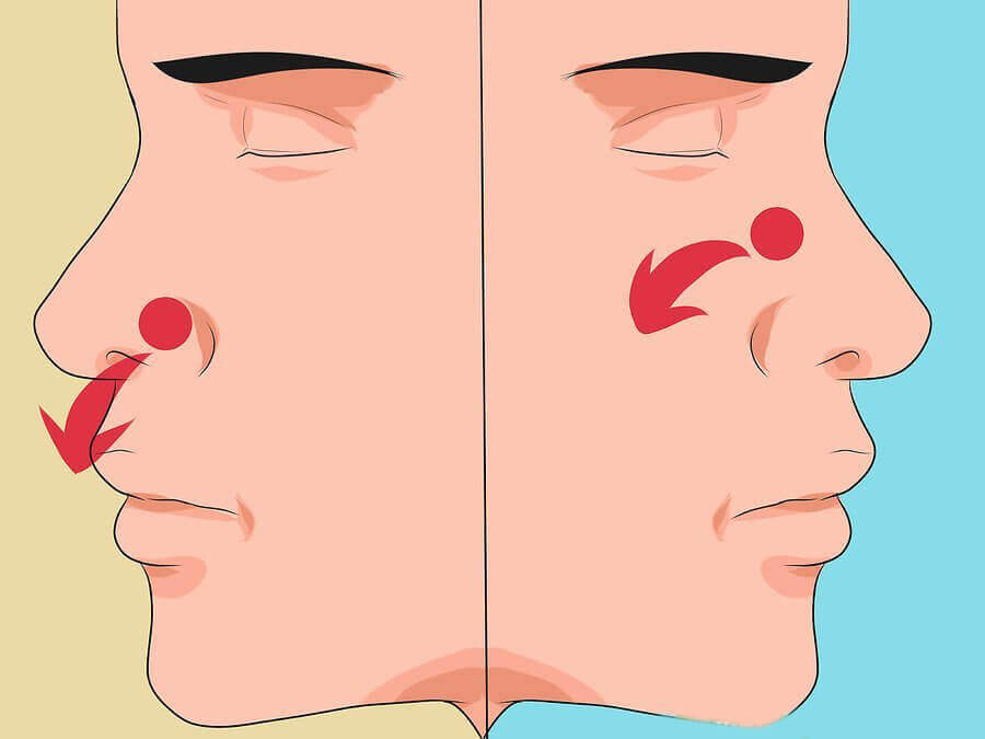 Hiperosmia, la excesiva sensibilidad a los olores