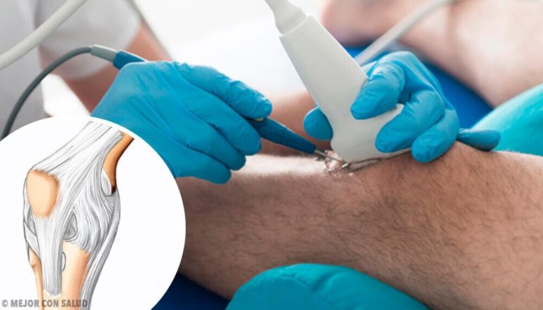ATENCIÓN: Cirugía de rodilla: ¿cuáles son los riesgos?