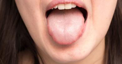 ATENCIÓN: ¿Qué pasa cuando la saliva es espesa?