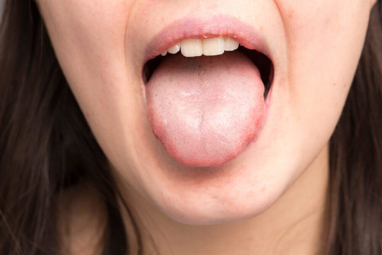 ATENCIÓN: ¿Qué pasa cuando la saliva es espesa?