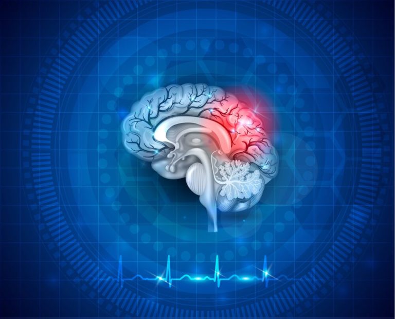 ¿Qué es la neuroplasticidad?