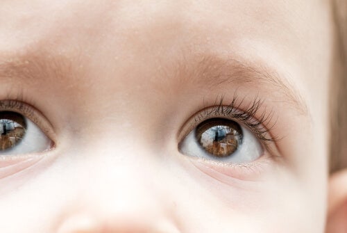 ATENCIÓN: El glaucoma infantil