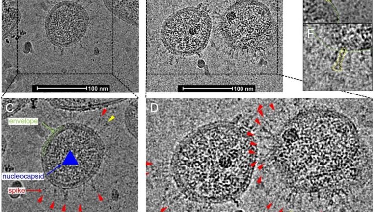 Captan las primeras imágenes con la forma real del nuevo coronavirus