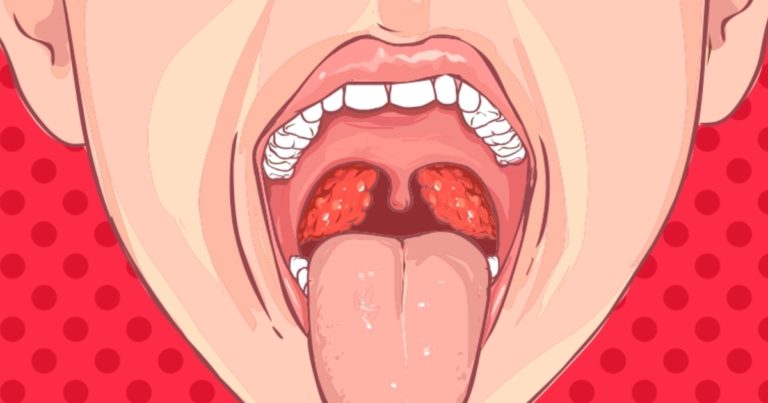 ¿Cómo calmar la irritación de garganta?