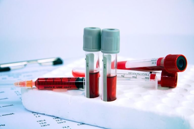 ANEMIA