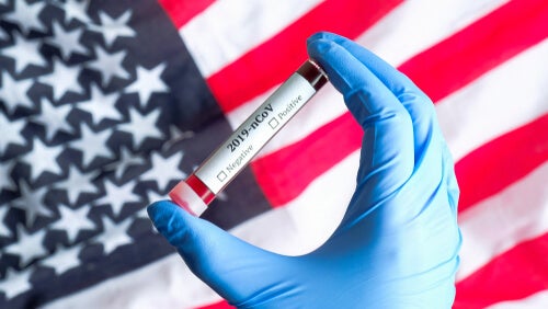 EE.UU. empieza a probar la vacuna del COVID-19 en humanos
