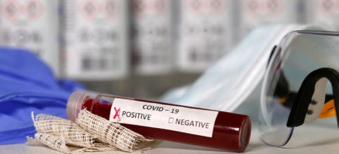 Coronavirus: Salud Pública ya recibió las pruebas rápidas para el Covid-19