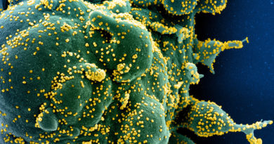 El covid-19 podría atacar las células del sistema inmunitario como el VIH