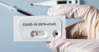 Cancillería de RD anuncia llegada de veintiséis mil pruebas para COVID-19