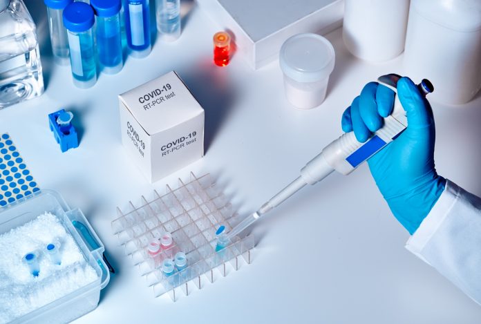 Escasez kits de pruebas limita la confirmación del contagio de Covid-19