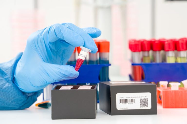Detección del coronavirus: ¿qué es una PCR?