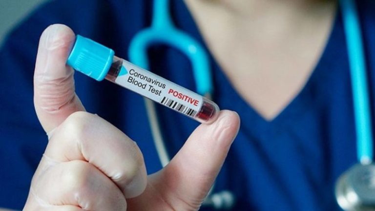 Coronavirus: Procuraduría realiza pruebas a más de 800 agentes de vigilancia penitenciaria