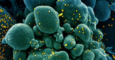 Científico ruso sugiere que el coronavirus "se quedará con nosotros para siempre" porque "no controlamos su propagación"