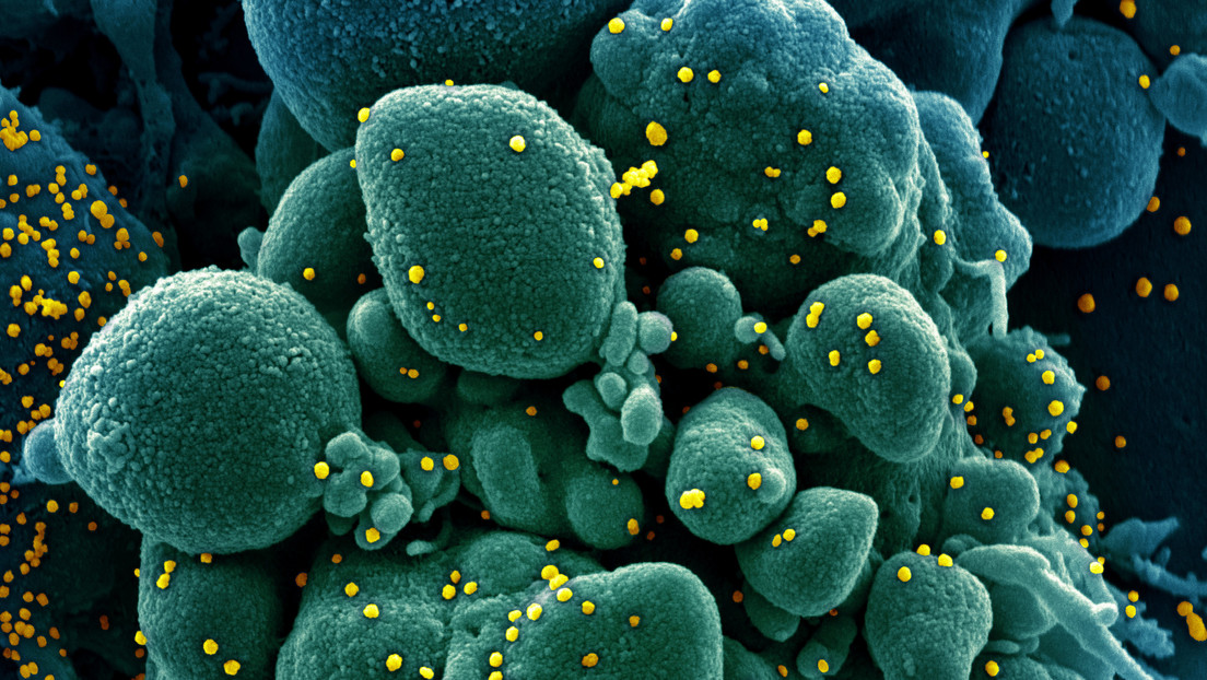 Científico ruso sugiere que el coronavirus "se quedará con nosotros para siempre" porque "no controlamos su propagación"