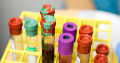 Científicos rusos planean registrar varias vacunas contra el covid-19 en agosto y septiembre