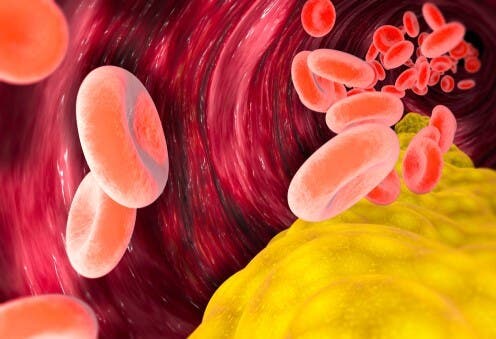 ¿Es perjudicial el colesterol VLDL?