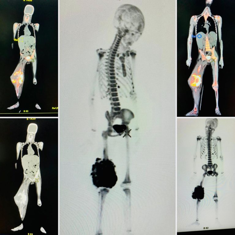 Estudio PETCT Óseo ya es posible realizarlo en República Dominicana