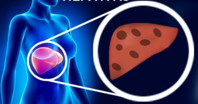 ¿Existen remedios naturales para la hepatitis?