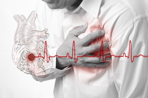 Cómo detectar los falsos infartos