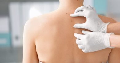Tumores benignos en la piel: ¿cómo se manifiestan?