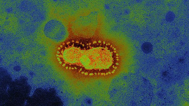 Coronavirus en un microscopio.