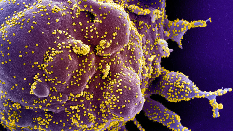Descubren que el coronavirus infecta las células del corazón y se multiplica en ellas