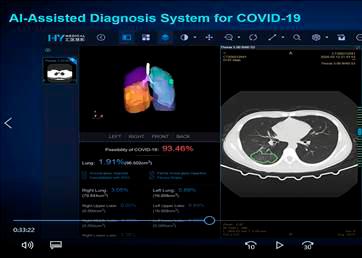 Claro instala en Santiago segundo sistema de diagnóstico de COVID-19 basado en Inteligencia Artificial