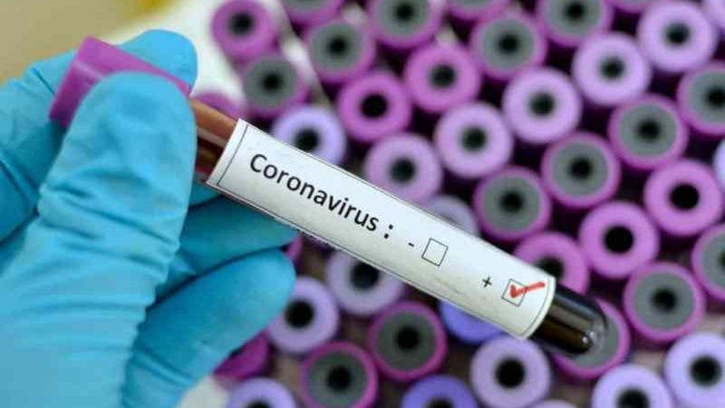 Coronavirus RD: 22,572 casos confirmados y nueve defunciones en últimas 24 horas