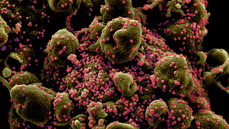¿Cuánto tiempo permanece el coronavirus en el cuerpo de una